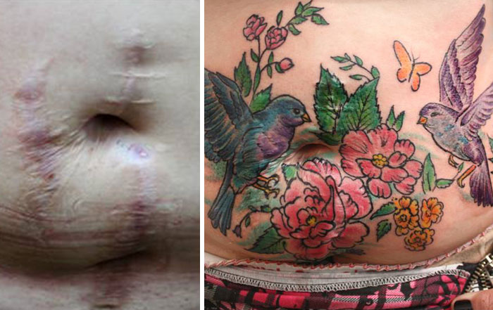 mastectomy-abuse-scar-women-free-tattoo-flavia-carvalho-daedra-art-brasil-5