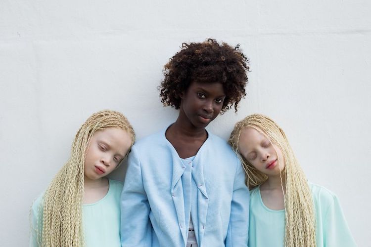 Na zdjęciu są trzy siostry - 2 Albinoski i jedna ciemnoskóra dziewczyna. Dwie Bliżniaczki stoją po dwóch stronach trzeciej siostry i mają głowy oparte na jej ramieniach. Mają zamknięte oczy. Ciemnoskóra dziewczyna patrzy się prosto do kamery i lekko się uśmiecha.