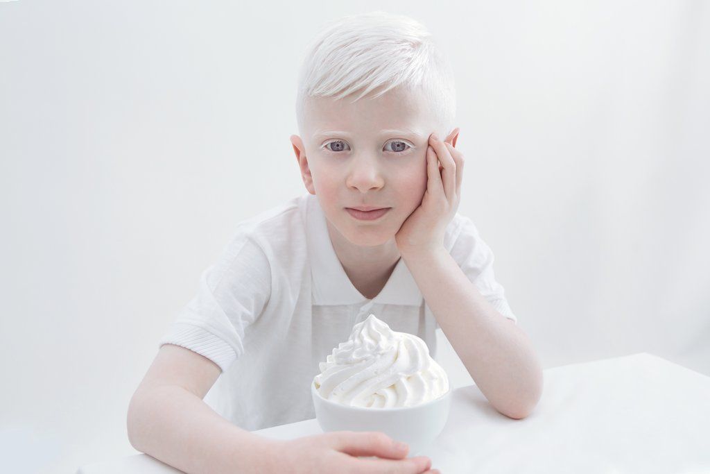 Fotografia kolorowa utrzymana w bialych odcienaich. Na zdjęciu widać siedzącego przy białym stole chłopca-albinosa. Lewą ręką podpiera głowę, a prawa położona jest na blacie. Przy prawej dłono widać białą miseczkę wypełnioną bitą śmietaną.