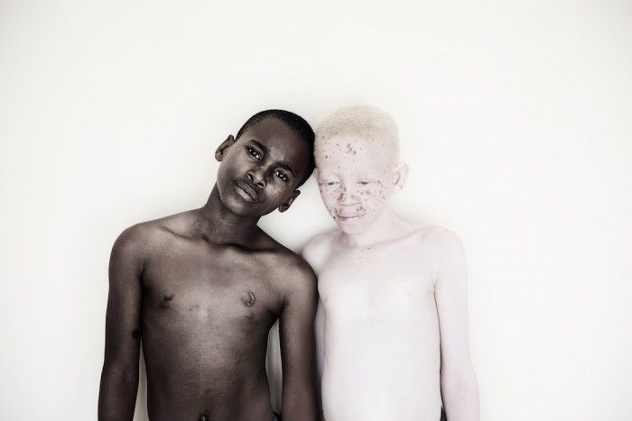 Rówieśnicy pozują. Czarny i albinos.