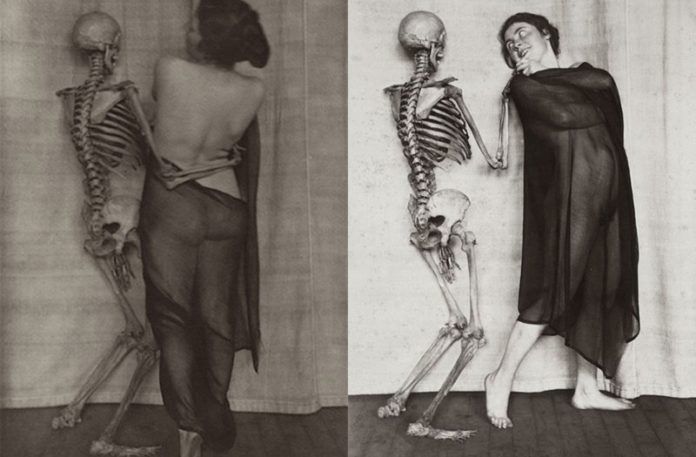 Dwie fotografie przedstawiające kobiety pozujące ze szkieletami