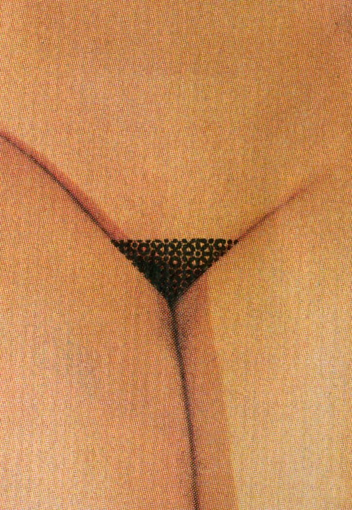 Fragment ciała kobiety zasłonięty cenzurą