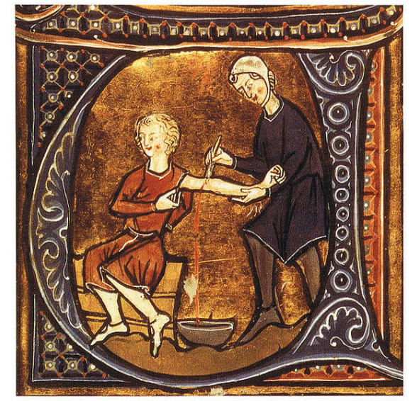 medieval doctor 10 Średniowieczne obrazki, które wprawiają w zakłopotanie
