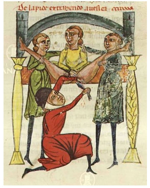 medieval doctor 12 Średniowieczne obrazki, które wprawiają w zakłopotanie