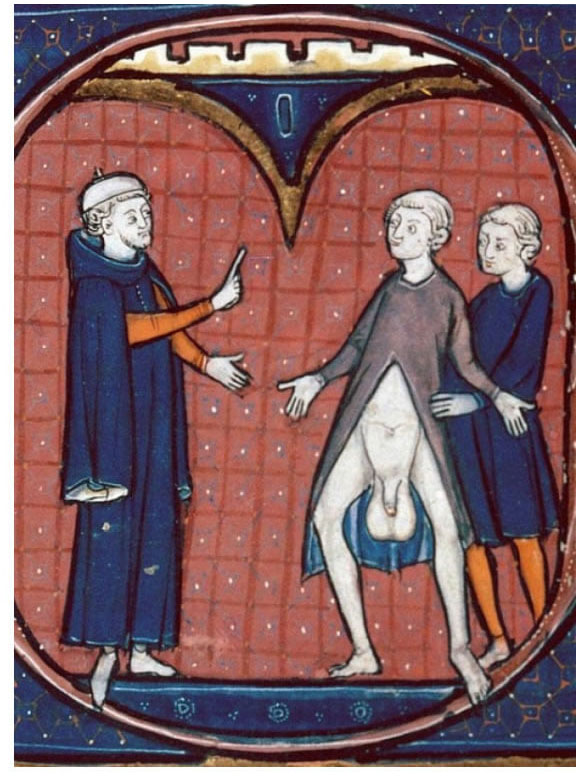 medieval doctor 9 Średniowieczne obrazki, które wprawiają w zakłopotanie