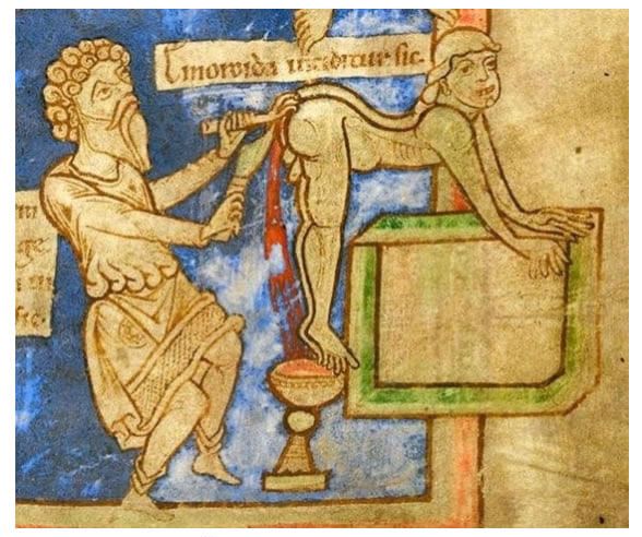 medieval doctor 17 Średniowieczne obrazki, które wprawiają w zakłopotanie