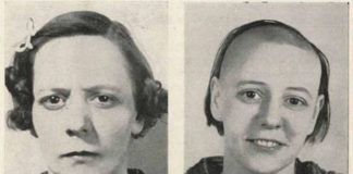 Dwa zdjęcia tej samej kobiety - skrzywionej i uśmiechniętej