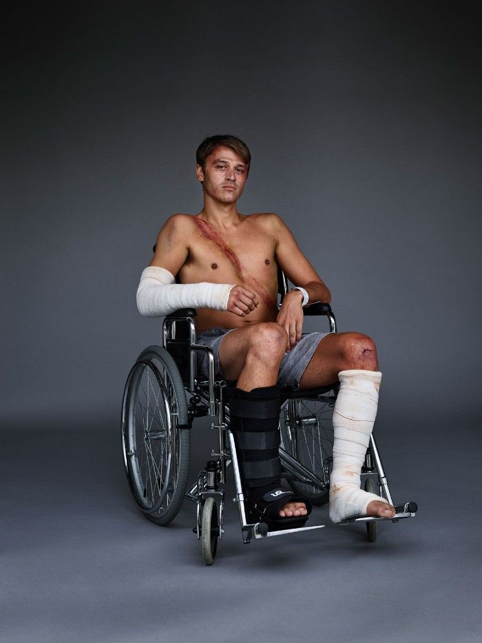 Mężczyzna z ranami po wypadku samochodowym na wózku inwalidzkim